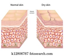 Dry skin, eps8 Dry skin, eps8