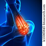 Elbow pain