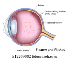 Floaters and Flashes, eps10 Floaters and Flashes, eps10