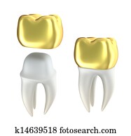 Golden Dental crowns and tooth Golden Dental crowns and tooth
