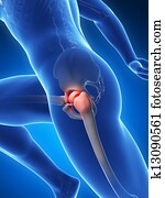 Highlighted hip joint pain Highlighted hip joint pain