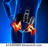 Hip pain