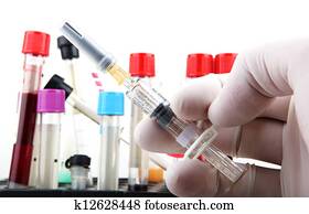 Influenza vaccine Influenza vaccine