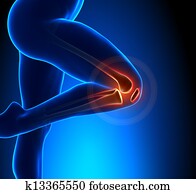 Knee pain Knee pain
