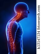 Kyphotic spine lateral view in x-ray Kyphotic spine lateral view in x-ray