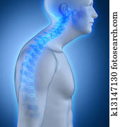Kyphotic spine lateral view Kyphotic spine lateral view