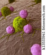 Leukocytes attacking a cancer cell Leukocytes attacking a cancer cell