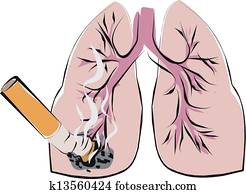 lung cancer lung cancer