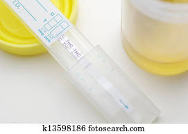 Marijuana Drug Test Marijuana Drug Test