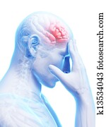 Migraine/headache Migraine/headache