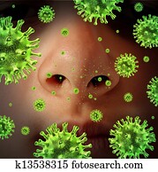 Nasal Infection Nasal Infection