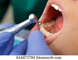 professionelle, dental, bürsten