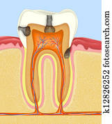 rotten tooth rotten tooth