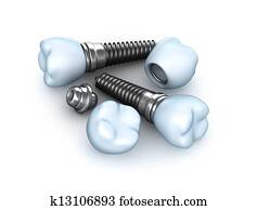 Set of dental implants Set of dental implants