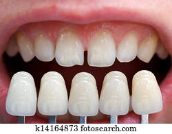 Shade determination Shade determination