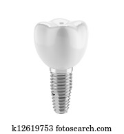 Tooth implant Tooth implant