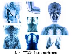 x-ray
