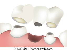 השרש, שיניים