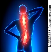 זכר, כאב, חוט שדרה, -, כאב