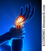 כאב, שורש היד