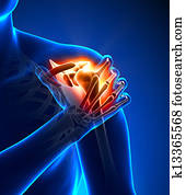 כתף, כאב, -, כאב, טראומה