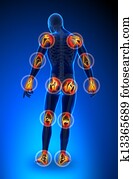 מפרקים, כאב, -, טראומה