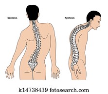 של השדרה, כעורים