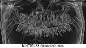 Human Teeth. X-Ray effect