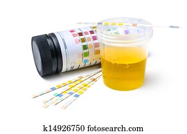 Urine test strips Urine test strips