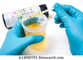 Urine test strips Urine test strips