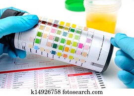Urine test strips Urine test strips