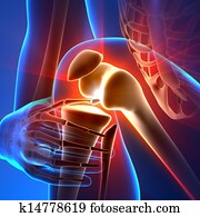 כאב, ברך, -, אנטומיה, קרנות