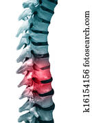 back pain back pain