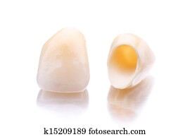 Close-up of two prosthetic teeth