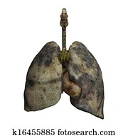 Lungs of Smokers