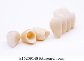 Macro of prosthetic teeth Macro of prosthetic teeth