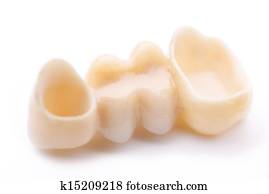 Macro of three prosthetic teeth