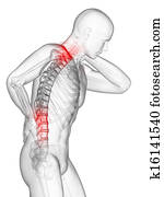 Painful back and neck Painful back and neck