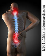 Painful back and neck Painful back and neck