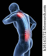 Painful back and neck Painful back and neck