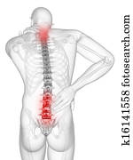 Painful back and neck Painful back and neck