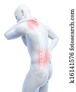 Painful back and neck Painful back and neck