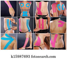 תרופה של אלטרנטיבה