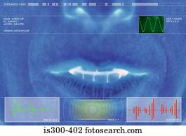 recognition voz, sistema