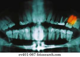 raio x dental