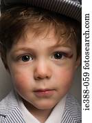 menino, com, um, ferimento