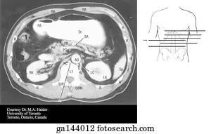 Transverse or horizontal (axial) MRI of the abdomen at the level of the lower L1.  Image at bottom illustrates level of scan (line D).