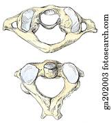 Clipart of Anterior view of the atlas and axis, an atlantoaxial joint ...