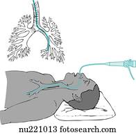 Stock Illustration of Larynx, trachea, bronchi, and lungs ca207009 ...