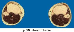 γάμπα, -, πόδια